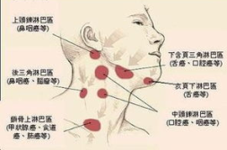 淋巴结核症状,从初期肿块到晚期溃疡的演变